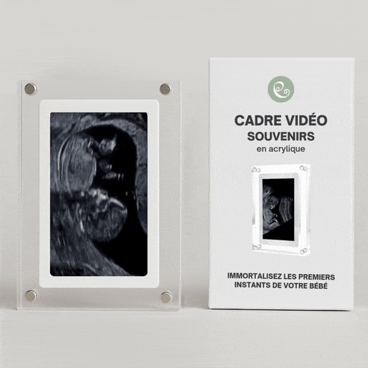 CadreMagic™ ⎮ Cadre Vidéo et Photo Échographie